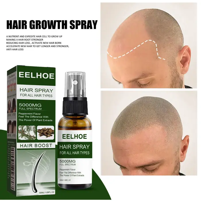 Spray anti-chute pour soins capillaires, cheveux épais, forts et beaux, anti-chute, raffermissant et