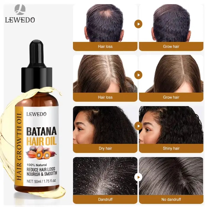 Sérum d'huile de Batana pour la croissance des cheveux