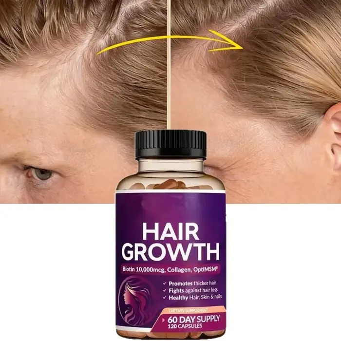 Nouveau Complément Capillaire 2026 : Soutient la Densité des Cheveux, Nourrit les Racines du Cuir Chevelu, Augmente le Volume pour des Cheveux Plus Fournis et Brillants en 2 Mois