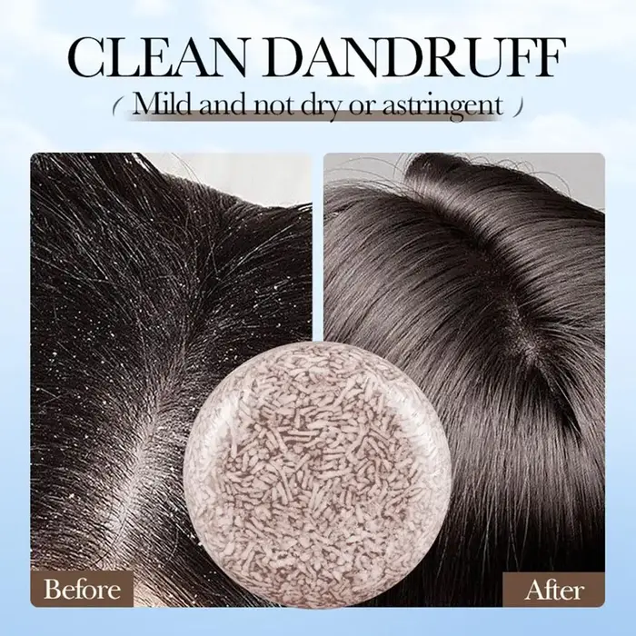 Barre de shampoing Polygonum, savon biologique pour le nettoyage en profondeur des cheveux, contrôle du sébum, renforce les racines des cheveux, shampoing pour soins capillaires, 1 à 5 pièces