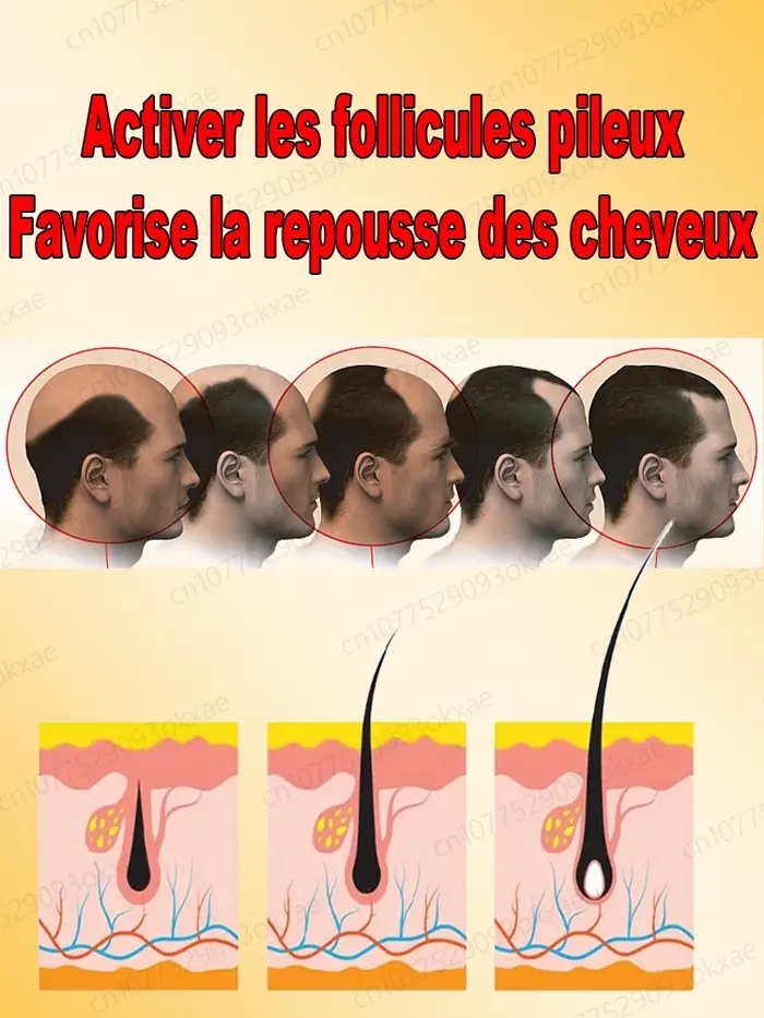 Le cuir chevelu était entièrement nourri