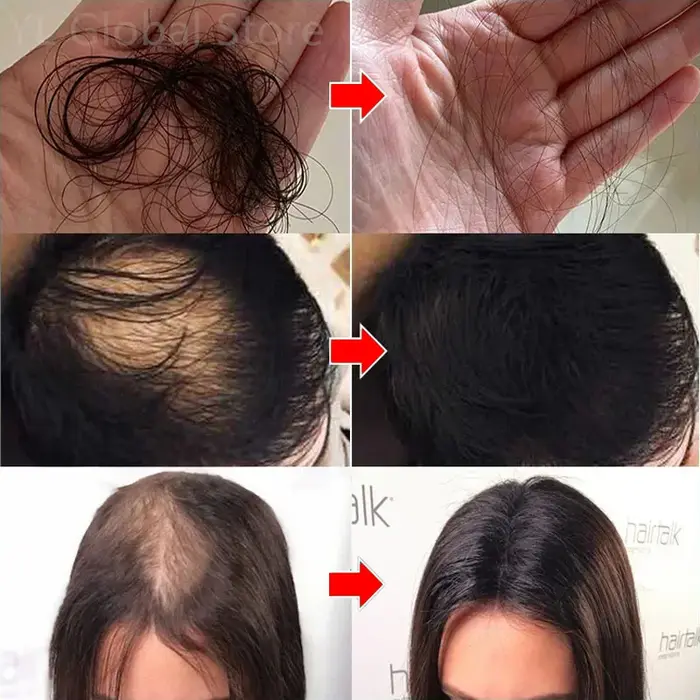 Sérum de croissance des cheveux à la rosemaine