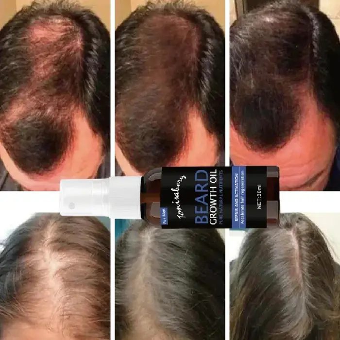 Sérum en spray pour la croissance de la barbe