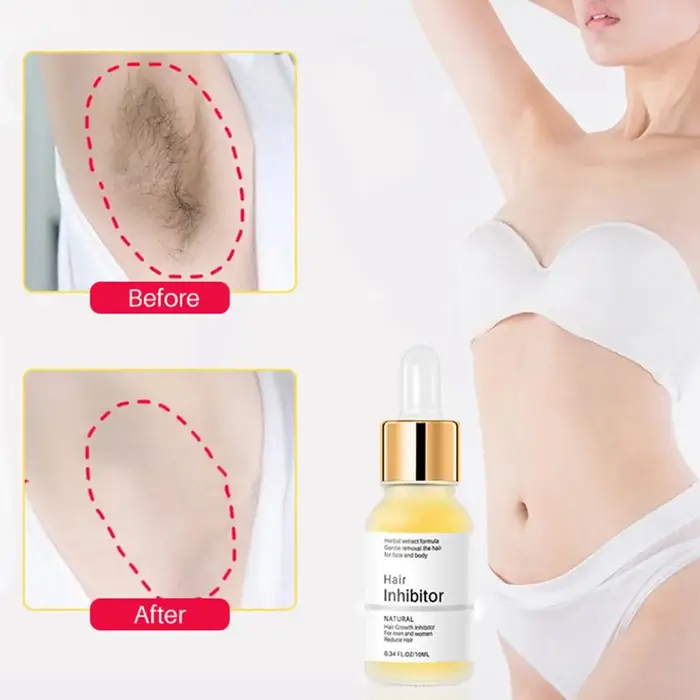 Sérum d'inhibition des cheveux