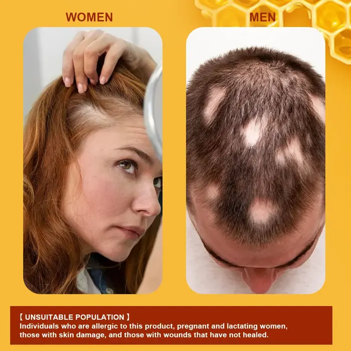 Crème de croissance des cheveux