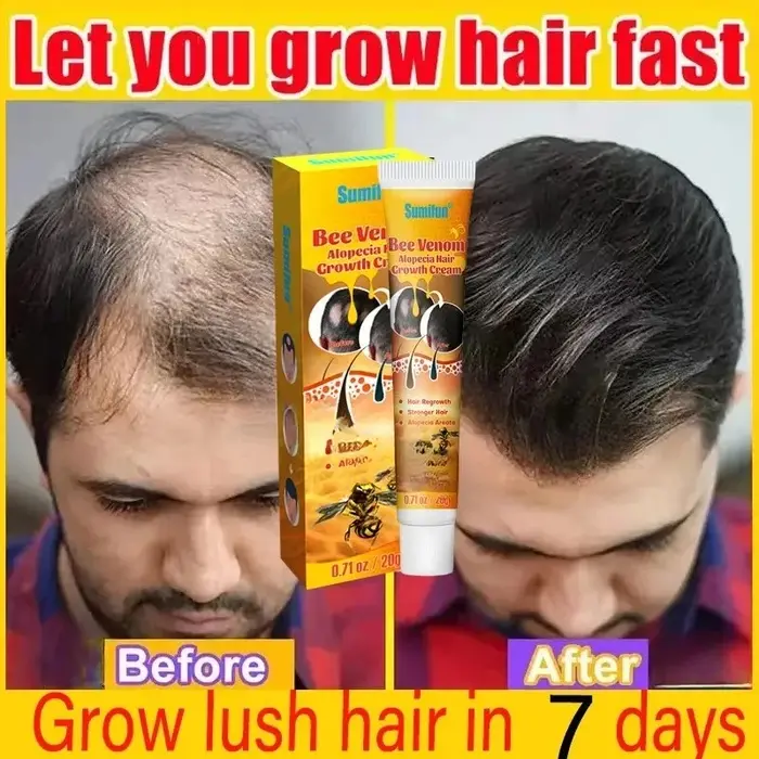 Crème de croissance des cheveux 7 jours