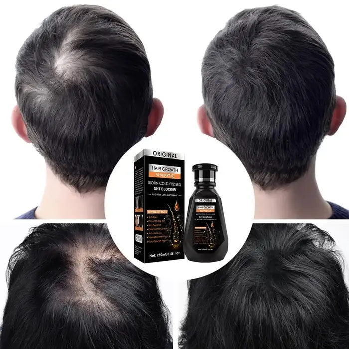 Shampoing pour la croissance des cheveux