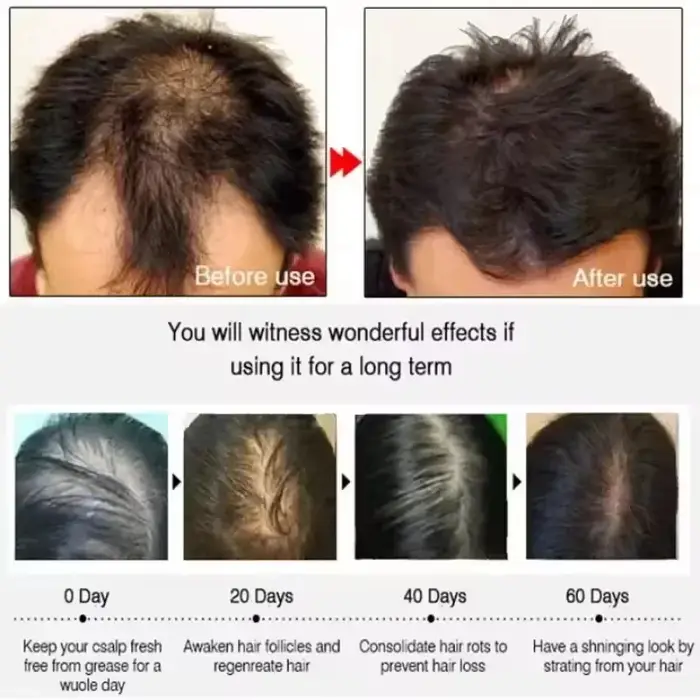 Crème de croissance des cheveux 7 jours
