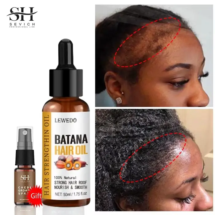Sérum d'huile de Batana pour la croissance des cheveux